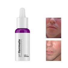 Chronic Redness / Sensitive