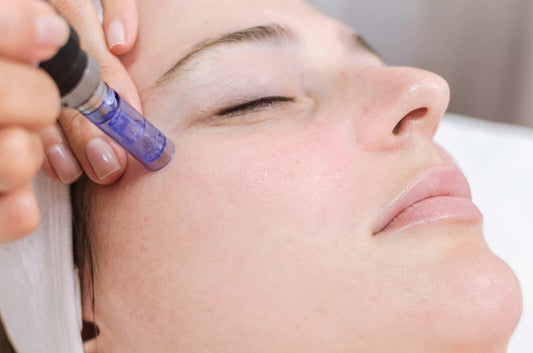 Micro Needling or Nano Needling Treatment