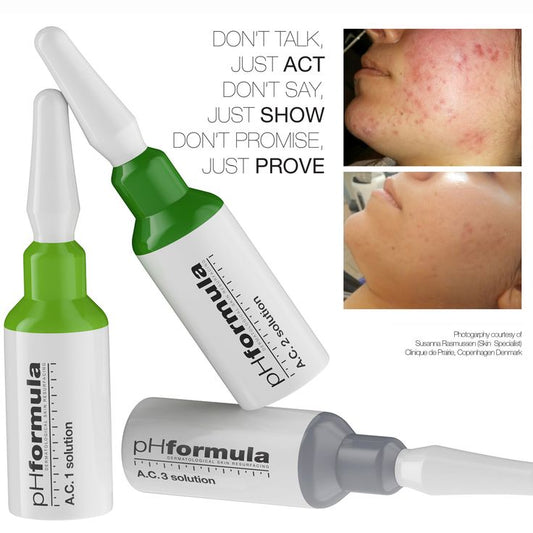 Acne Prone