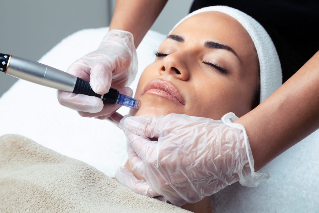 Micro Needling or Nano Needling Treatment
